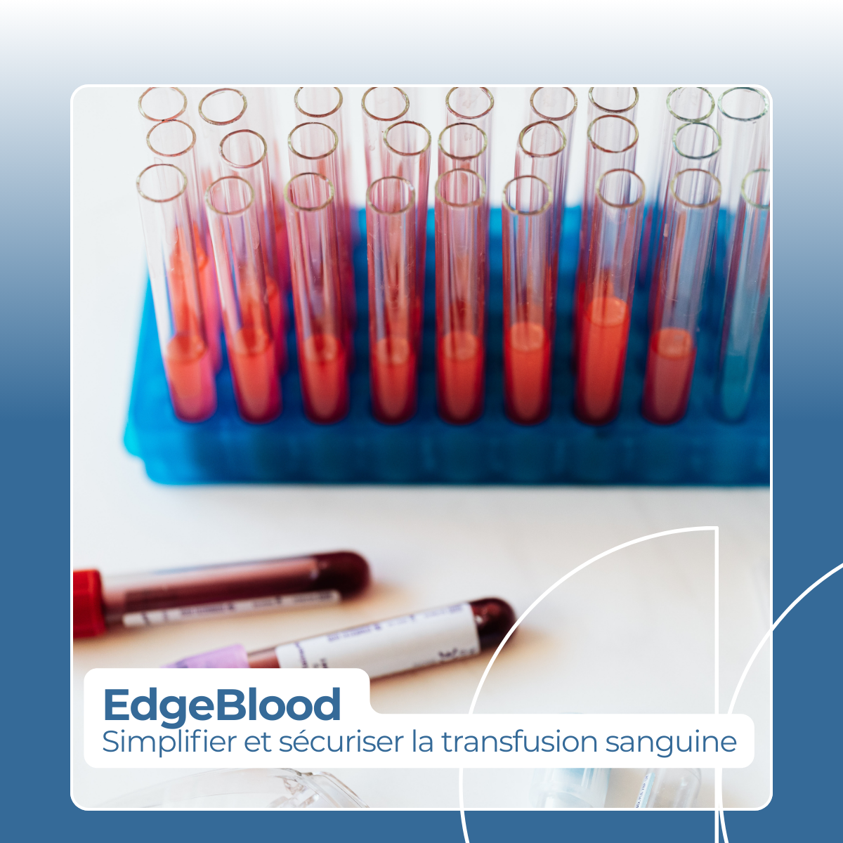 EdgeBlood : simplifier et sécuriser la transfusion sanguine